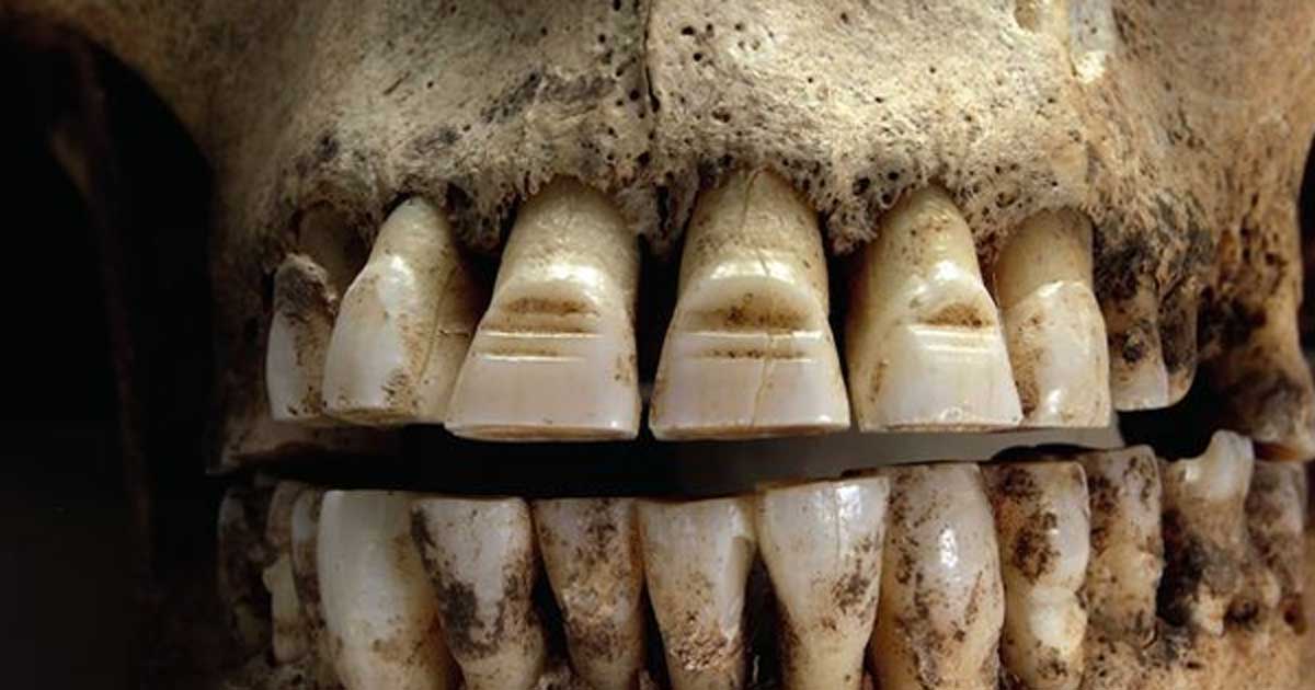 Anglo Saxon teeth